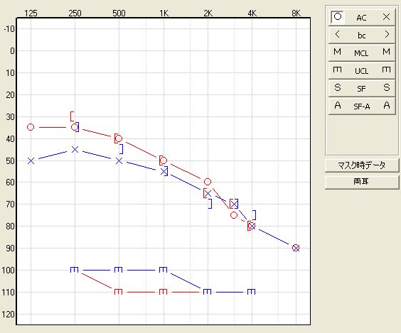 オーディオグラム測定例