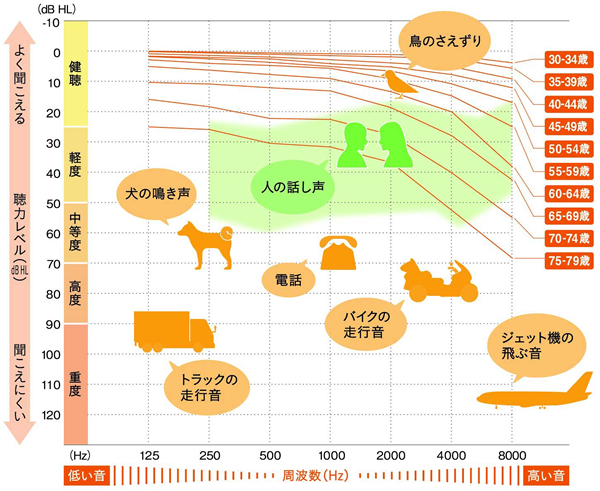 聴力レベル