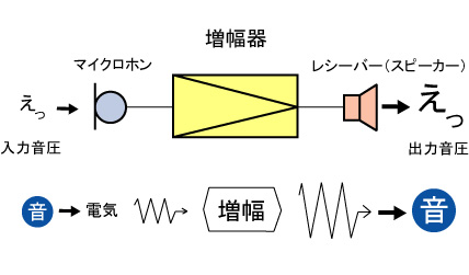 アナログ補聴器（従来補聴器）